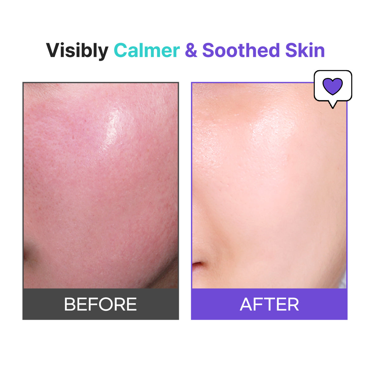 Snail & Azulene Calmfort Cream