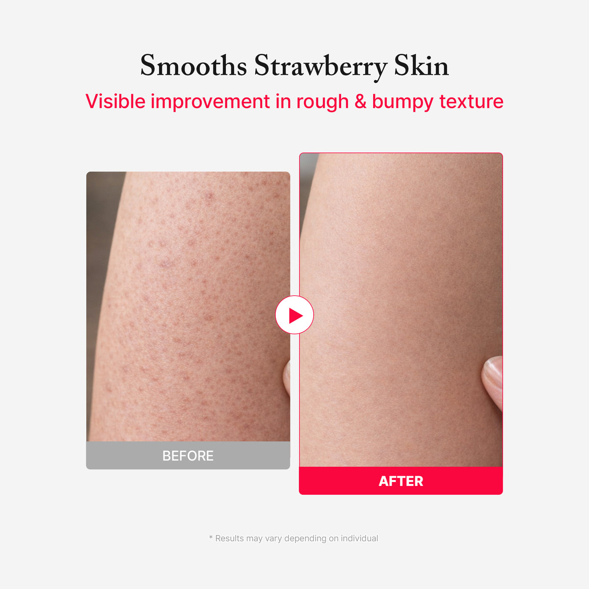 Anti Blemish Body Lotion