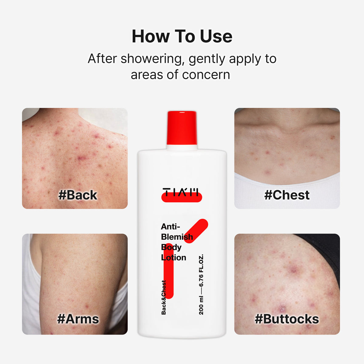 Anti Blemish Body Lotion