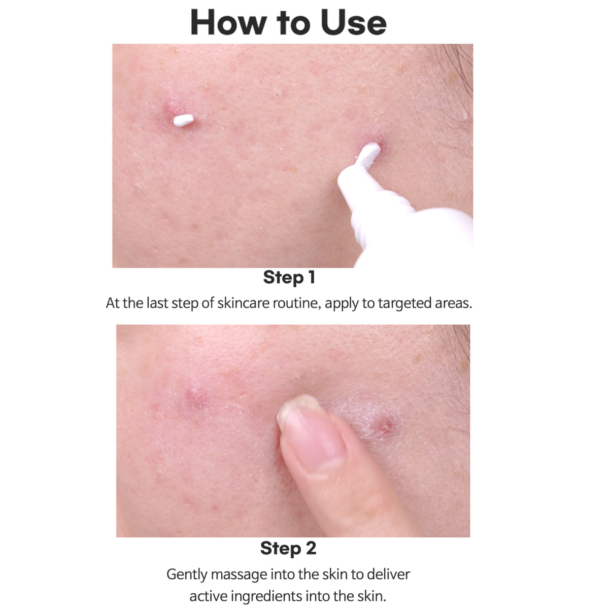 AC Fighting Spot Rx Cream