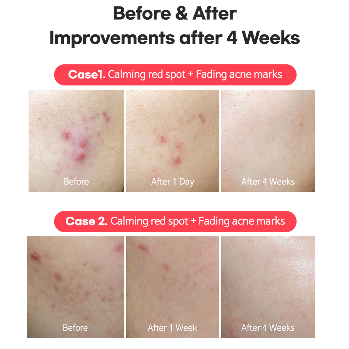 AC Fighting Spot Rx Cream