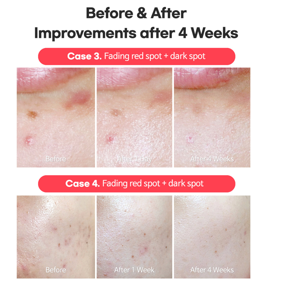 AC Fighting Spot Rx Cream