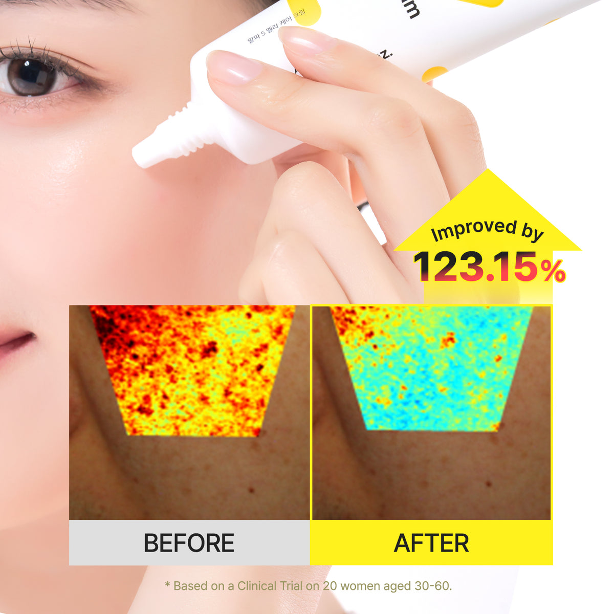 Alpha-5 Mela Care Cream
