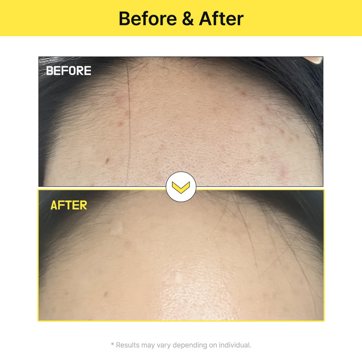 Alpha-5 Mela Care Cream
